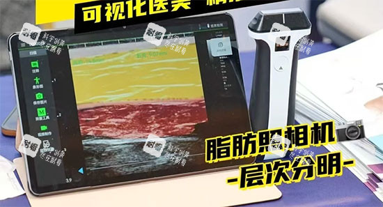 维密金雕实物设备图片