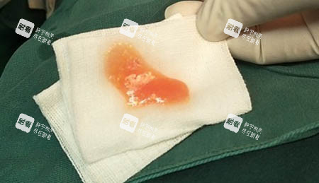 奥美定图片 奥美定图片