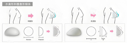 假体隆胸形状对比