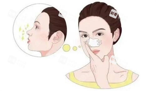 微晶瓷注射隆鼻 微晶瓷注射隆鼻