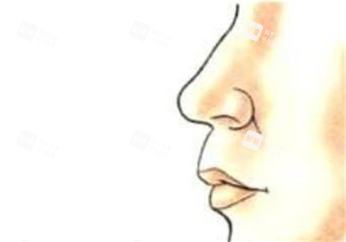 人中长凸嘴展示 人中长凸嘴展示