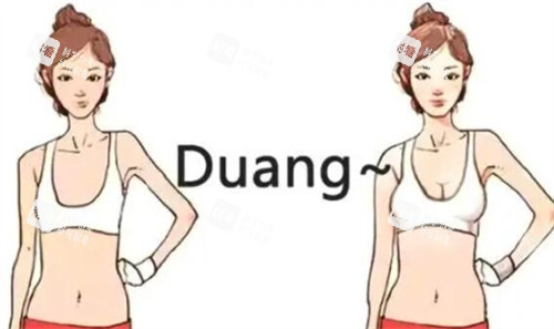 隆胸对比 隆胸对比