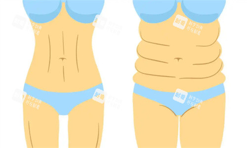 吸脂前后对比卡通图