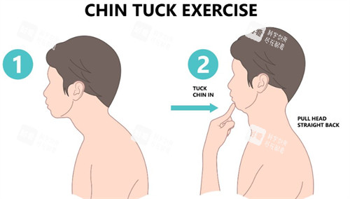 富贵包矫正前后