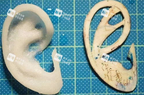 耳再造假体的形状 耳再造假体的形状