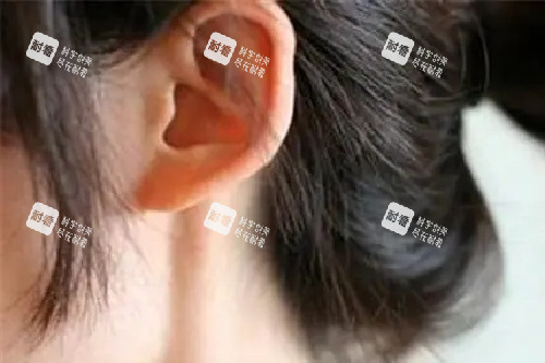 全耳再造.webp 全耳再造.webp