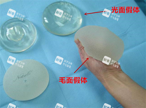 隆胸假体示意图 隆胸假体示意图