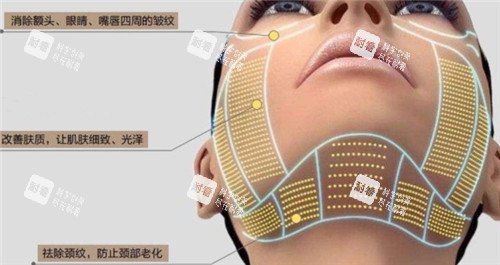 热玛吉皮肤作用细节图