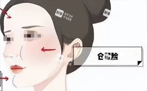 玻尿酸后馒化现象动画展示