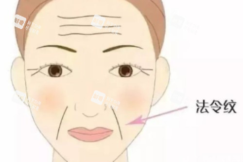 法令纹卡通图 法令纹卡通图