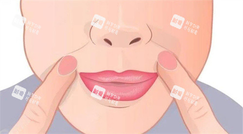 面部法令纹 面部法令纹