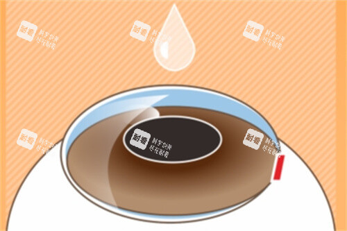 ICL滴麻药示意图 ICL滴麻药示意图