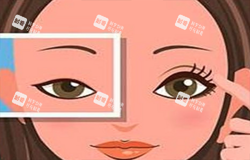 双眼皮对比