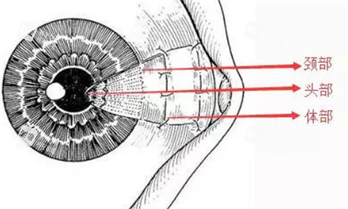 翼状胬肉手术需要切除部位图解 翼状胬肉手术需要切除部位图解