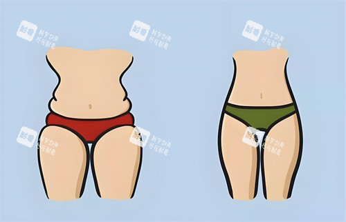 腿部吸脂手术前后对比正面动画图