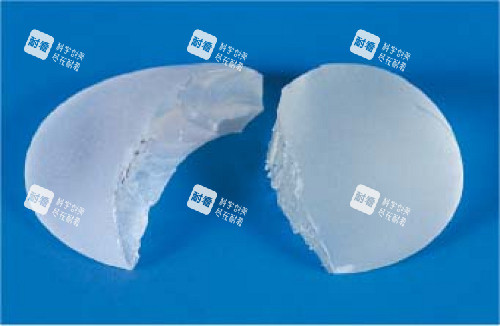 隆胸假体破裂后