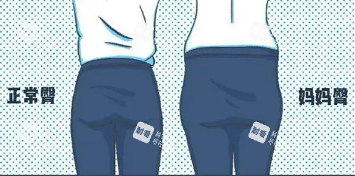 正常臀部和妈妈臀对比动画图