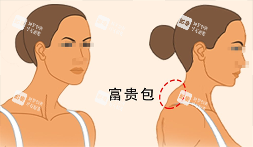 富贵包侧面展示图