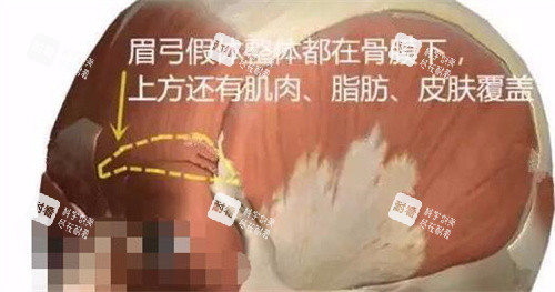 眉弓部位示意图展示