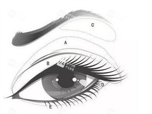 眉弓填充卡通图展示