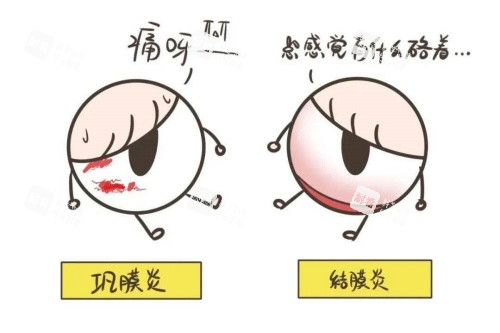 巩膜炎与结膜炎卡通对比图