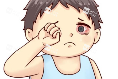 巩膜炎卡通一览图