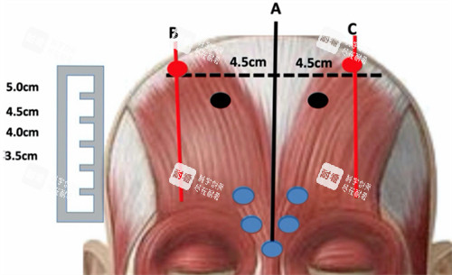 三点提眉是什么