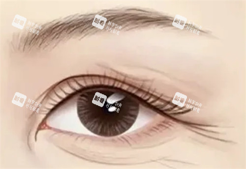 需要提眉切眉的情况