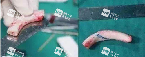 肋骨雕刻细节图