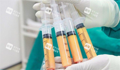 脂肪胶和自体脂肪的区别 脂肪胶和自体脂肪的区别