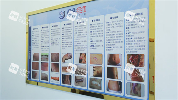 哈尔滨双举专科门诊部疤痕分类介绍