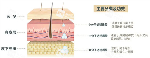 玻尿酸注射后皮肤变化