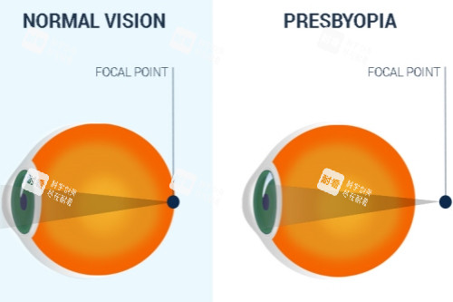 老花眼图片 老花眼图片