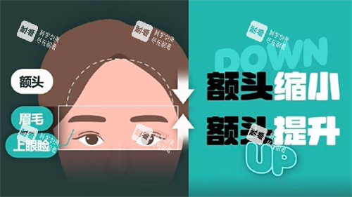 额头缩小和额头提升卡通