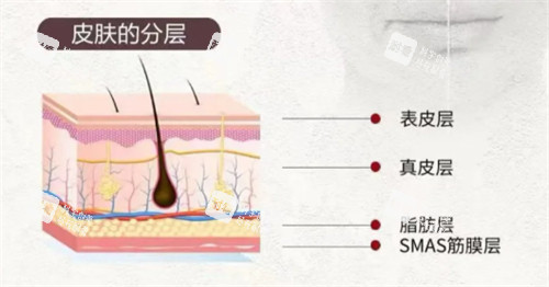 softwave索夫波适用皮肤层次