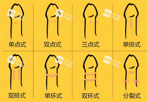 入珠的不同形式