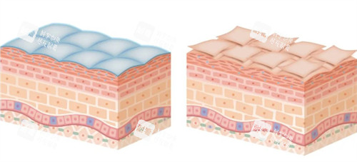 皮肤屏障受损前后对比