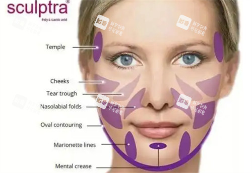 舒颜萃童颜针可治疗部位