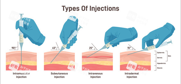 阴道紧缩针进针角度 阴道紧缩针进针角度
