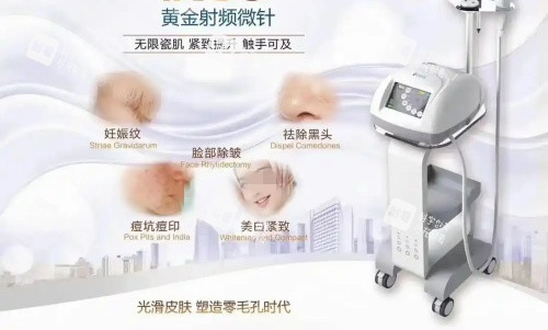 伊诺锶黄金微针治疗部位示意图