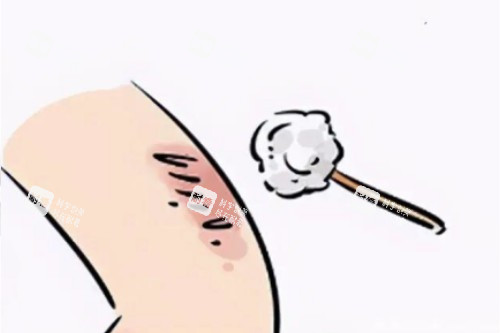 皮肤疤痕卡通图片展示