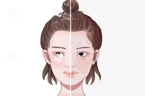 面部皮肤改善图 面部皮肤改善图