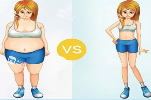 吸脂前后对比展示一览