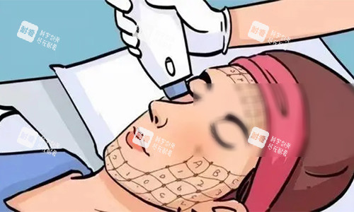 热玛吉的动画操作图 热玛吉的动画操作图