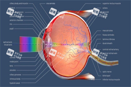 近视（屈光不正）