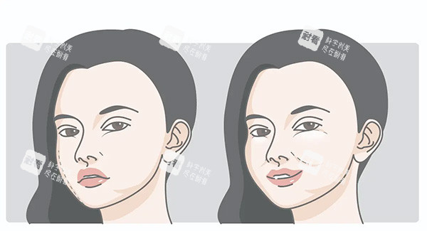 馒化脸对比照片 馒化脸对比照片