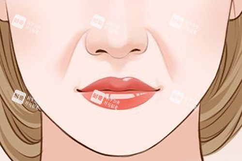 面部法令纹卡通示意图