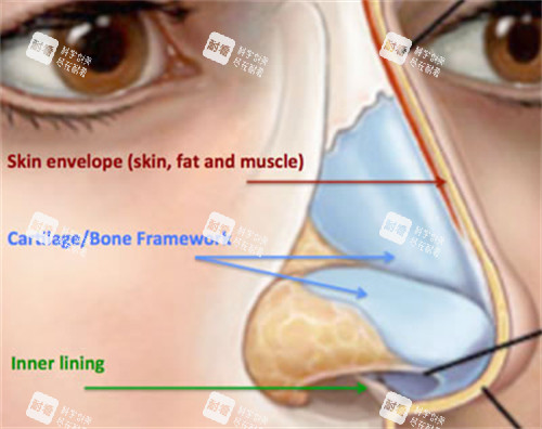 长鼻修复矫正对比 长鼻修复矫正对比