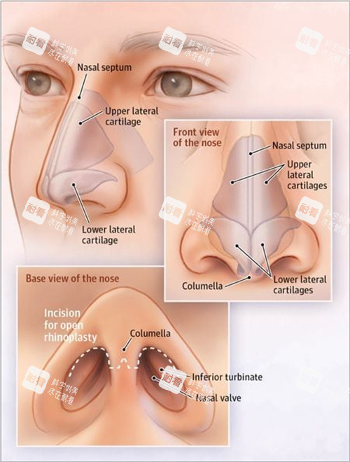 鼻修复细节图一览 鼻修复细节图一览