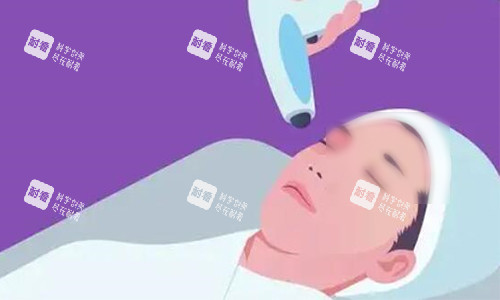 热玛吉操作示意图